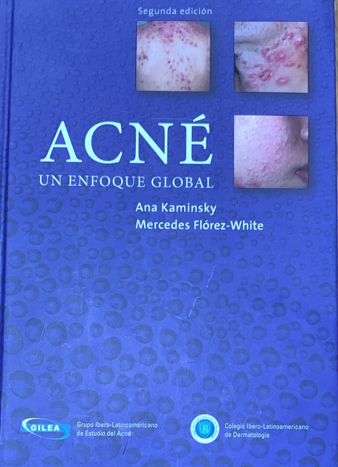 Acné: un enfoque global / Tapa Dura