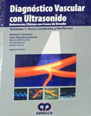 Diagnóstico vascular con ultrasonido: Referencias clínicas con casos de estudio. Volumen 1: Vasos cerebrales y periféricos – Segunda edición / Tapa Dura
